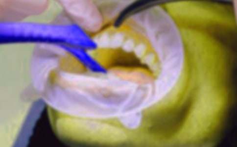 �������v����