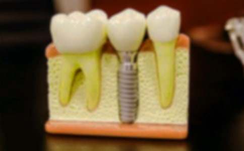 ����ӛ����2ƪ��ͨ�ã�