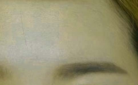 ��������üë�ļ���